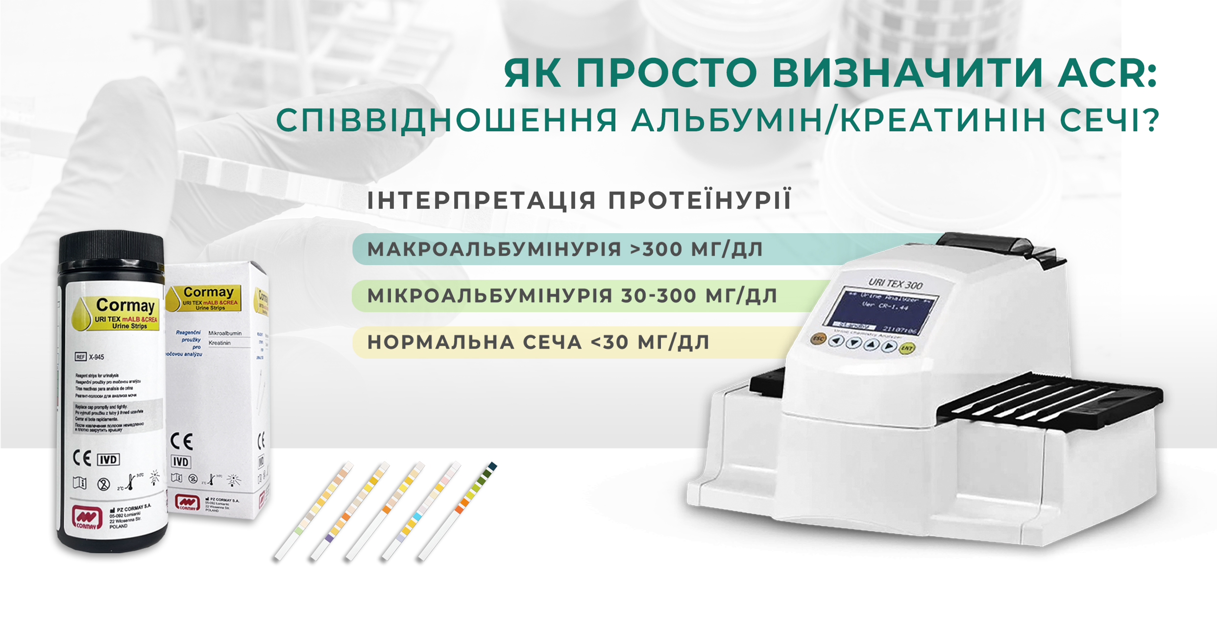 Новини Аналізатор сечі Diameb 1200_630
