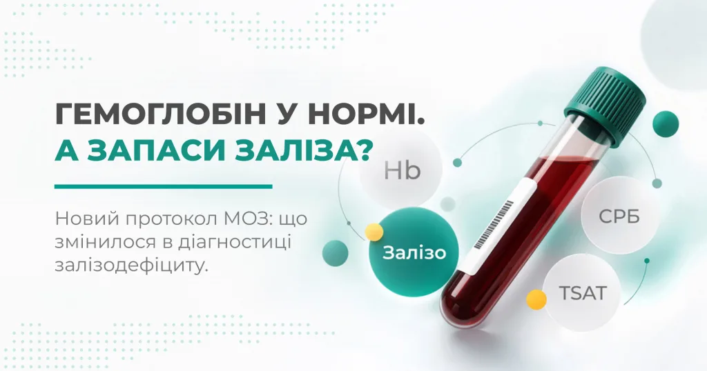 ГЗ-30